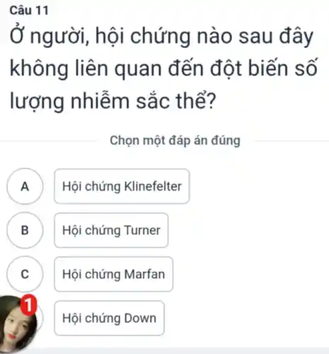 Câu 11
Ở người, hội chứng nào sau đây
không liên quan đến đột biến số
lượng nhiễm sắc thể?
Chọn một đáp án đúng
A Hội chứng Klinefelter
B Hội chứng Turner
D
C
Hội chứng Marfan
Hội chứng Down