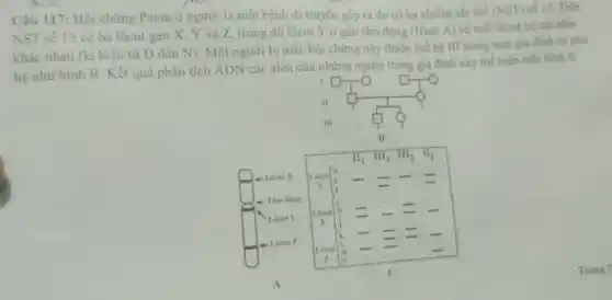 Câu 117: Hội chứng Patau ở người là một bệnh di truyền gây ra do có ba nhiểm sắc thể (NST) số 13. Trên hệ như hình B. Kết quả phân tích ADN các alen của những người trong gia đỉnh này thể hiện trên hình B